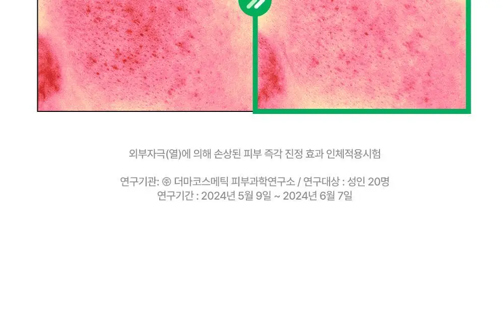 [밀착진정] 듀이트리 AC 딥 진정 마스크 1매 (열감/흔적) 상세페이지 73